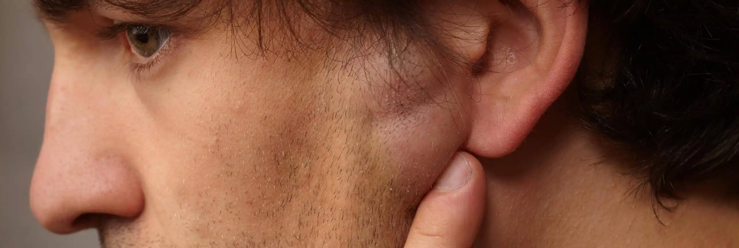 Pourquoi est-il important de surveiller son lipome ? | Centre chirurgie dermatologique | Paris