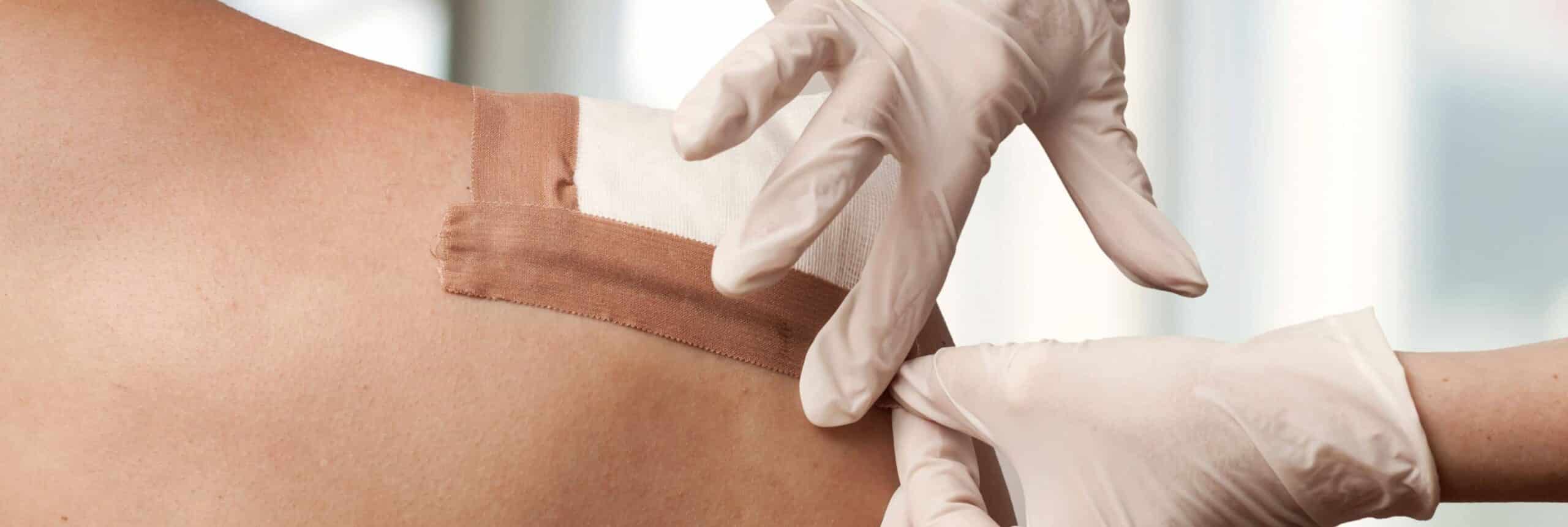Comment soigner un abcès ? | Centre chirurgie dermatologique | Paris