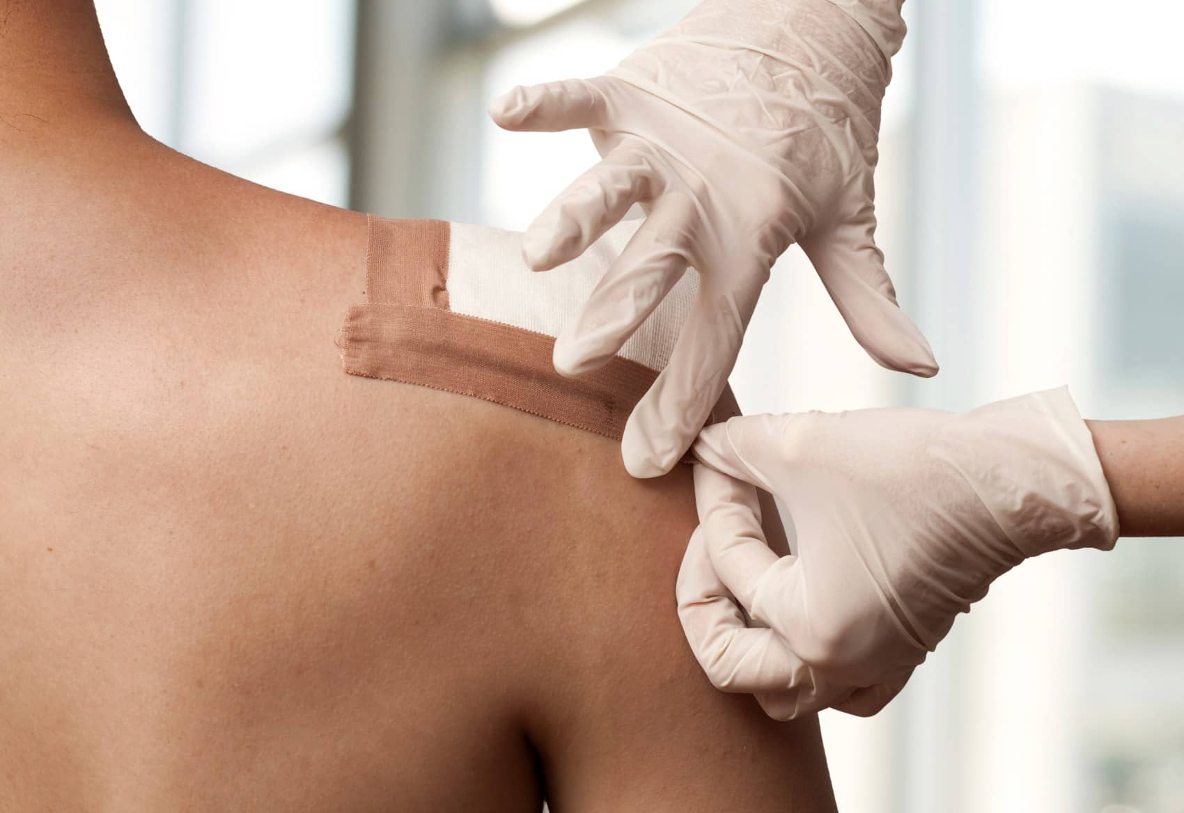 Comment soigner un abcès ? | Centre chirurgie dermatologique | Paris