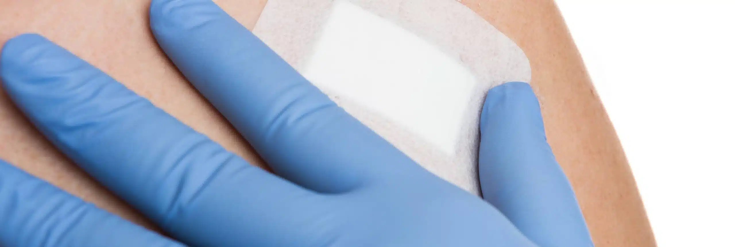 En quoi consiste le suivi post-chirurgical après l'ablation d'un mélanome ? | Paris
