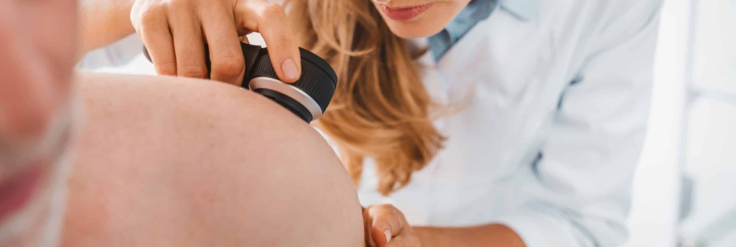 Chirurgiens dermatologues et lésions cutanées