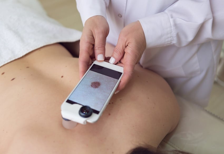 Traitement des melanomes
