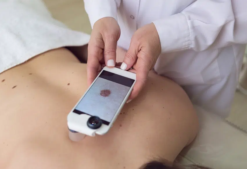 Traitement des melanomes
