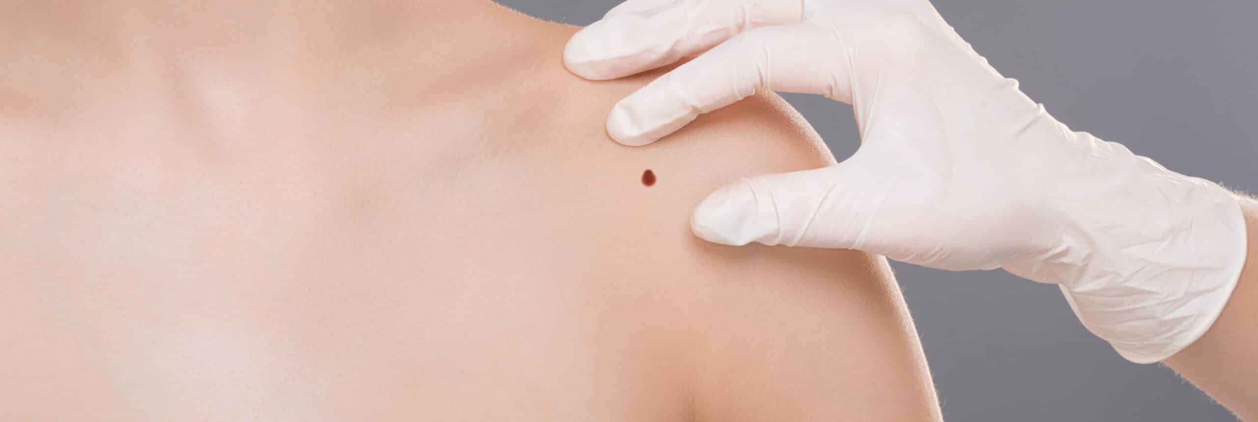 Techniques de chirurgie dermato