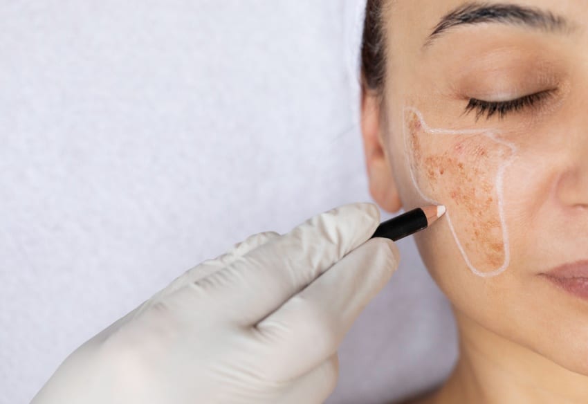 Chirurgie reconstructrice
