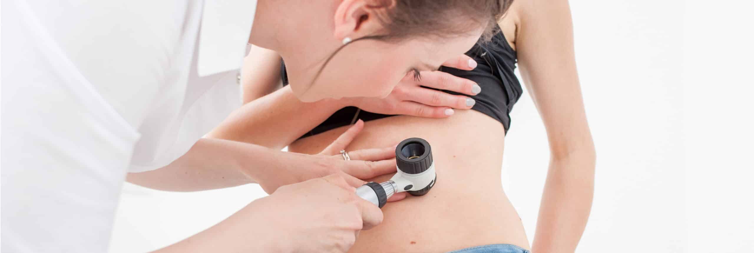 Chirurgie dermatologique