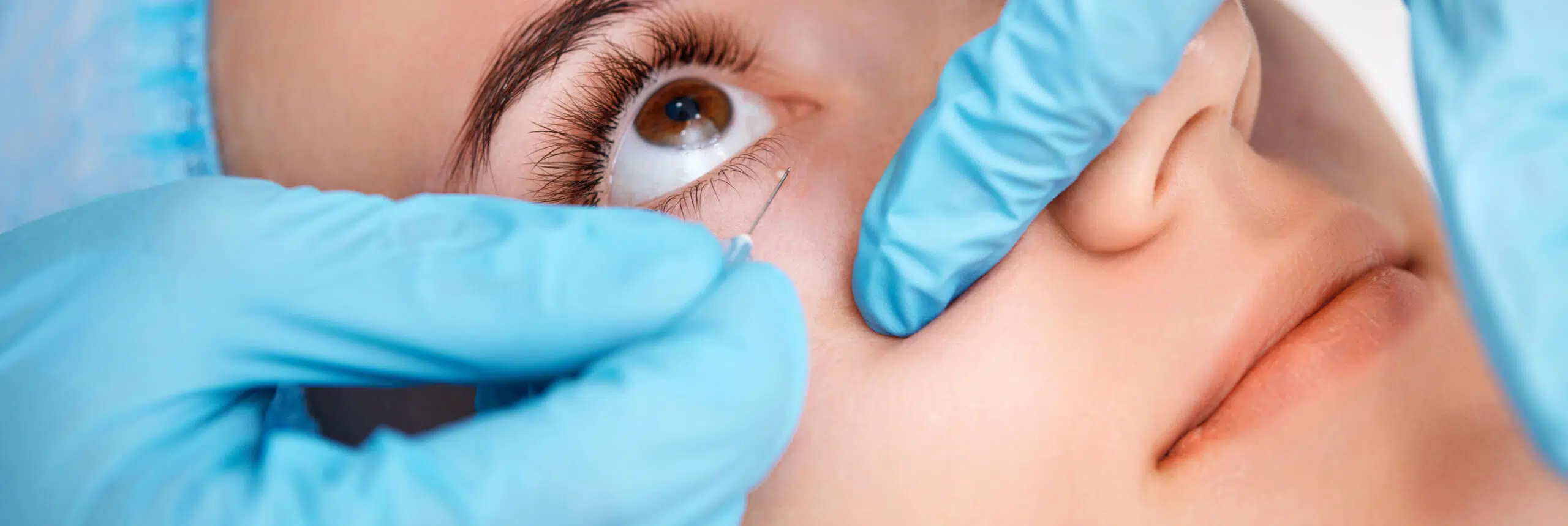 lipomes multiples faut tous enlever | SurgiSkin | Paris