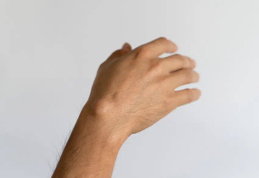 Comment éviter infection kyste cutané | Anaderm | Paris